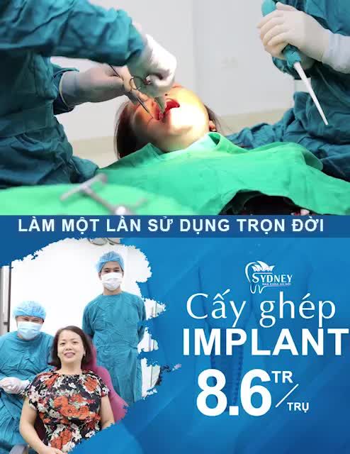 IMPLANT - CÂN TẤT CẢ CÁC TRƯỜNG HỢP MẤT RĂNG