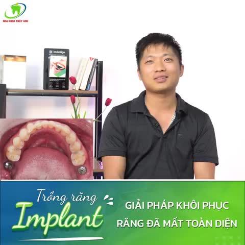 IMPLANT - LỰA CHỌN TỐI ƯU KHI MẤT RĂNG