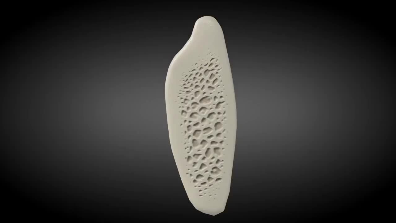 Khi có bác sĩ sẽ chỉ định ghép xương (bồi xương) để cấy ghép Implant.