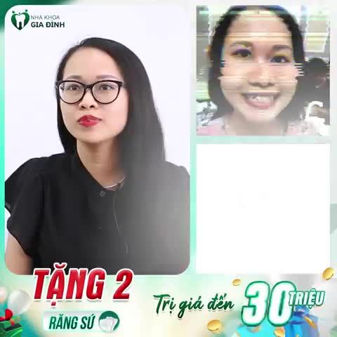 Là một người khá nhát, lại sợ đau nên khi nghĩ đến việc đi làm răng sứ thẩm mỹ chị Kiều Anh cũng đắn đo mãi xem có nên làm hay không