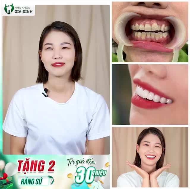 NGỠ NGÀNG TRƯỚC NỤ CƯỜI MỚI SAU KHI THẨM MỸ RĂNG SỨ