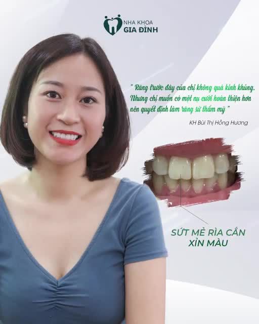 NỤ CƯỜI RẠNG RỠ CỦA BẠN CHÍNH LÀ MÓN QUÀ CHO NHỮNG NGƯỜI THÂN YÊU
