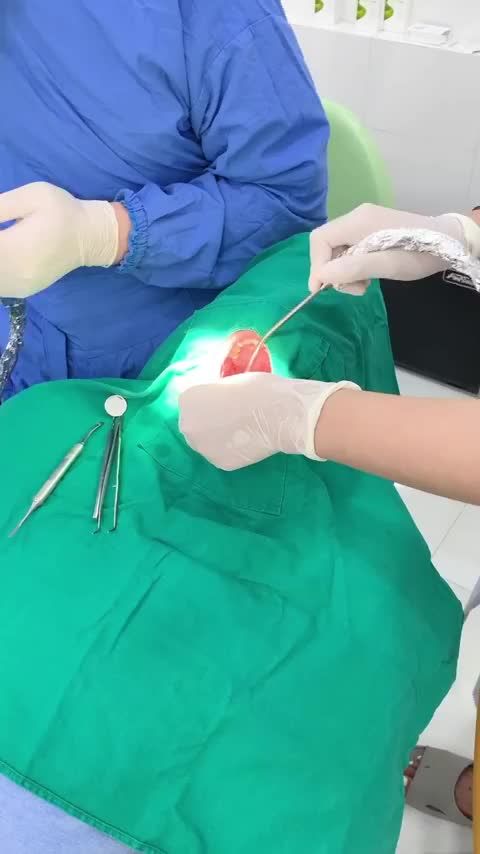 QUÁ TRÌNH CẤY GHÉP IMPLANT ĐẠT CHUẨN TẠI NHA KHOA GIA ĐÌNH