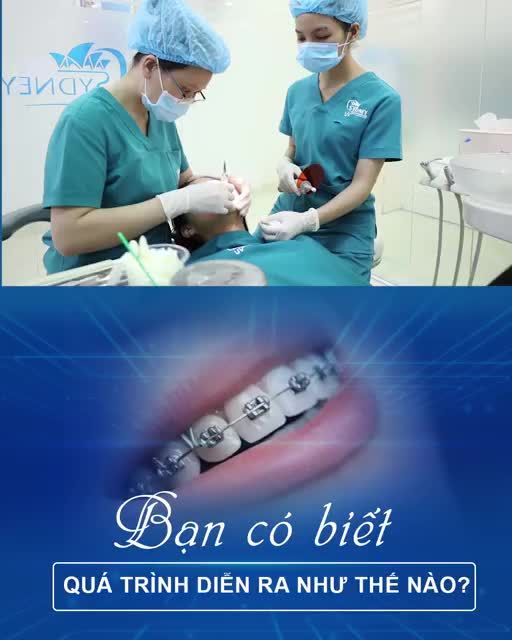QUÁ TRÌNH NIỀNG RĂNG DIỄN RA NHƯ THẾ NÀO