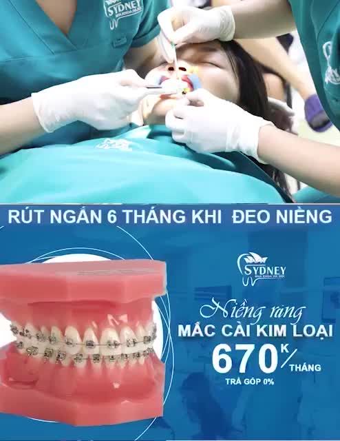 RĂNG BỊ CHẠY SAU KHI NIỀNG NGUYÊN NHÂN DO ĐÂU