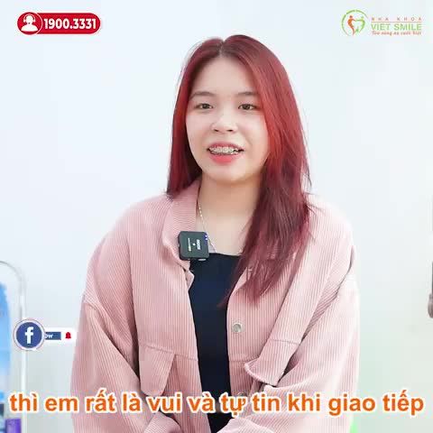 RĂNG SIÊU KHẤP KHỂNH THAY ĐỔI RA SAO SAU 1,5 NĂM NIỀNG RĂNG