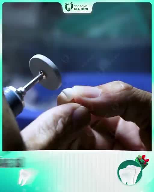 RĂNG SỨ CAO CẤP - KIỆT TÁC ĐẾN TỪ ĐÔI BÀN TAY CỦA NGƯỜI THỢ CHẾ TÁC