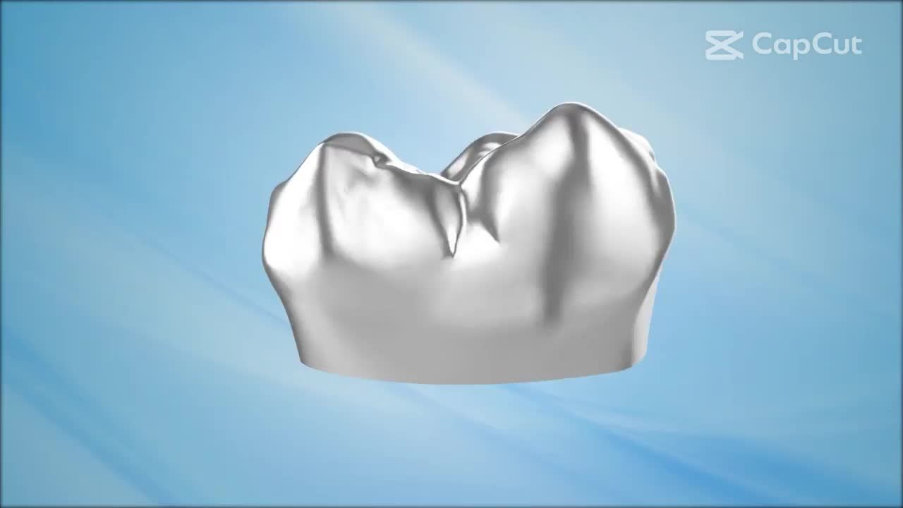 Răng sứ thẩm mỹ là gì