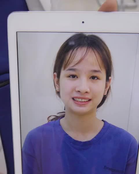 Sau 17 tháng niềng răng, bạn Thùy đã sở hữu nụ cười tự tin, rạng rỡ như mong ước.