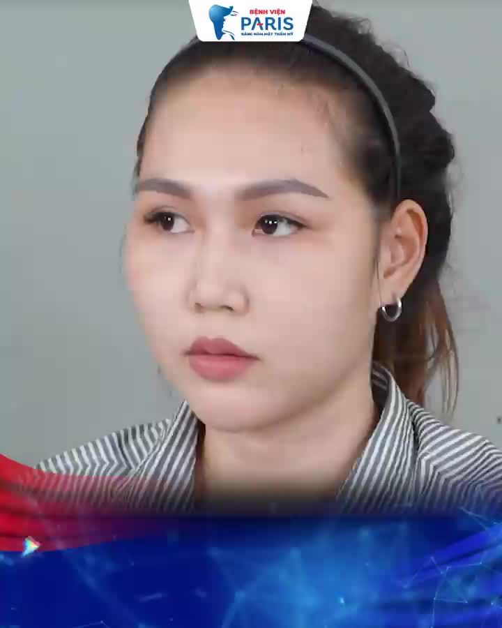 TẶNG NGAY 20 TR KHI PT HÀM MẶT
