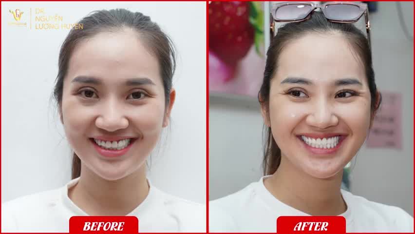 THĂNG HẠNG NỤ CƯỜI - SẮC ĐẸP LÊN NGÔI