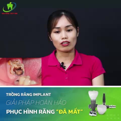 THAY THẾ CHIẾC RĂNG SÂU VỠ LỚN BỞI MỘT BẠN RĂNG IMPLANT CHẮC KHỎE