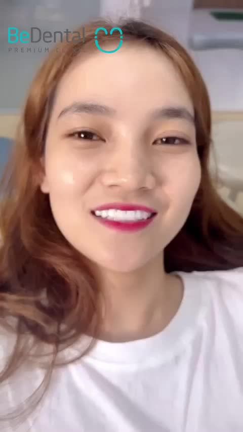 Thử thách 2 ngày làm thay đổi nụ cười tại nha khoa Bedental