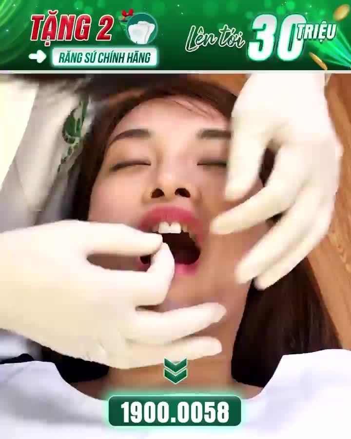 TÌM LẠI VẺ ĐẸP HOÀN HẢO SAU KHI THẨM MỸ RĂNG SỨ