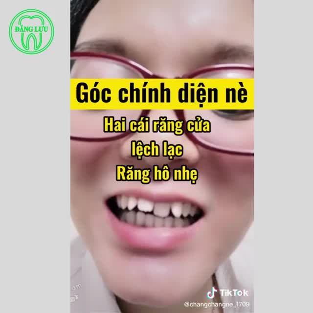Tôi của hiện tại, nhờ niềng răng mà trở nên tự tin & hạnh phúc hơn.