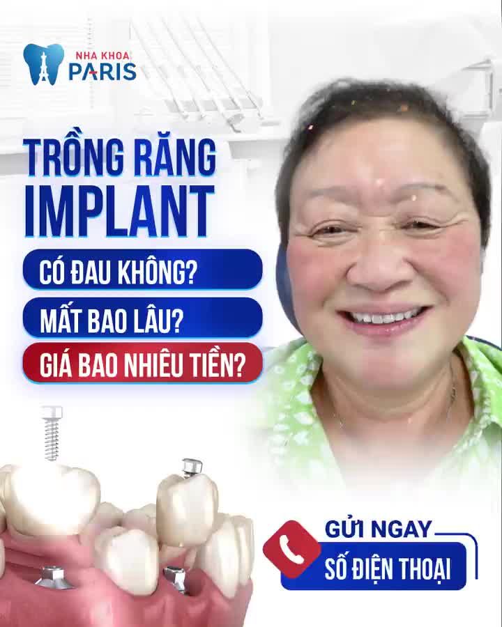 TRỒNG IMPLANT GIÁ TỐT NHẤT NĂM
