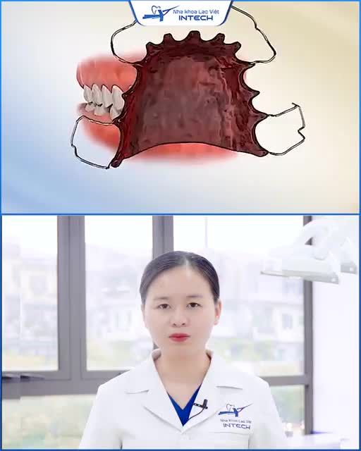 VAI TRÒ CỦA HÀM DUY TRÌ TRONG CHỈNH NHA
