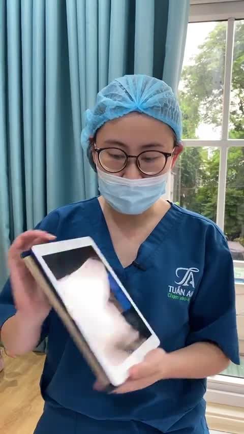 KHÁCH HÀNG TRẺ RA ĐẾN 5 TUỔI BẰNG PHƯƠNG PHÁP NÂNG CUNG MÀY