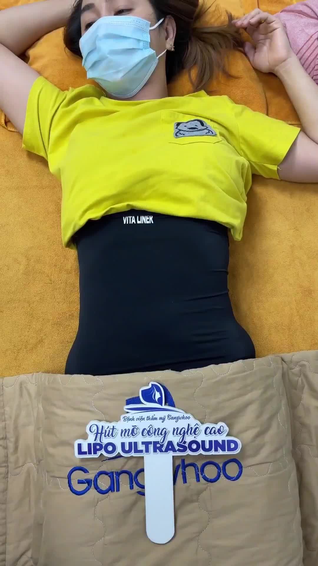 MẸ 3 CON CẤY TINH CHẤT GIẢM MỠ BỊ PHẢN TÁC DỤNG, DÙNG LIPO ULTRASOUND MỚI 1 NGÀY MÀ GỌN THON BẤT NGỜ