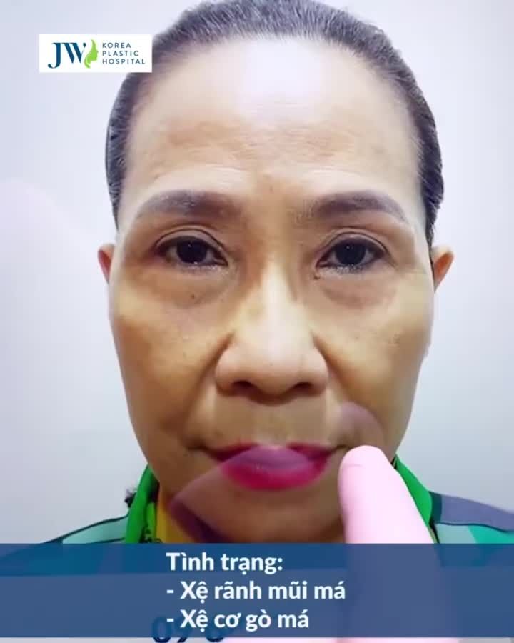 CẢI LÃO GƯƠNG MẶT 3M PHƯƠNG PHÁP TRẺ HÓA THẦN KỲ