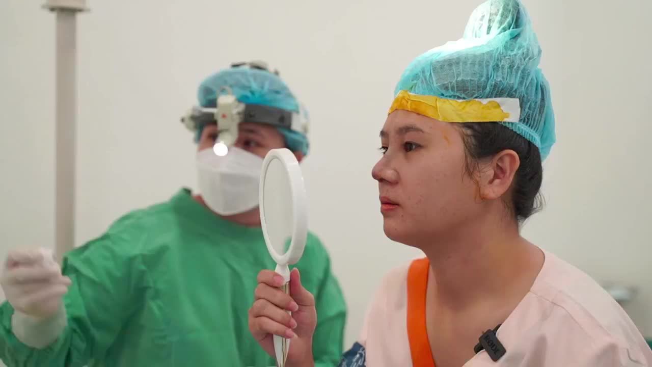 Ca nâng mũi cấu trúc sụn tai