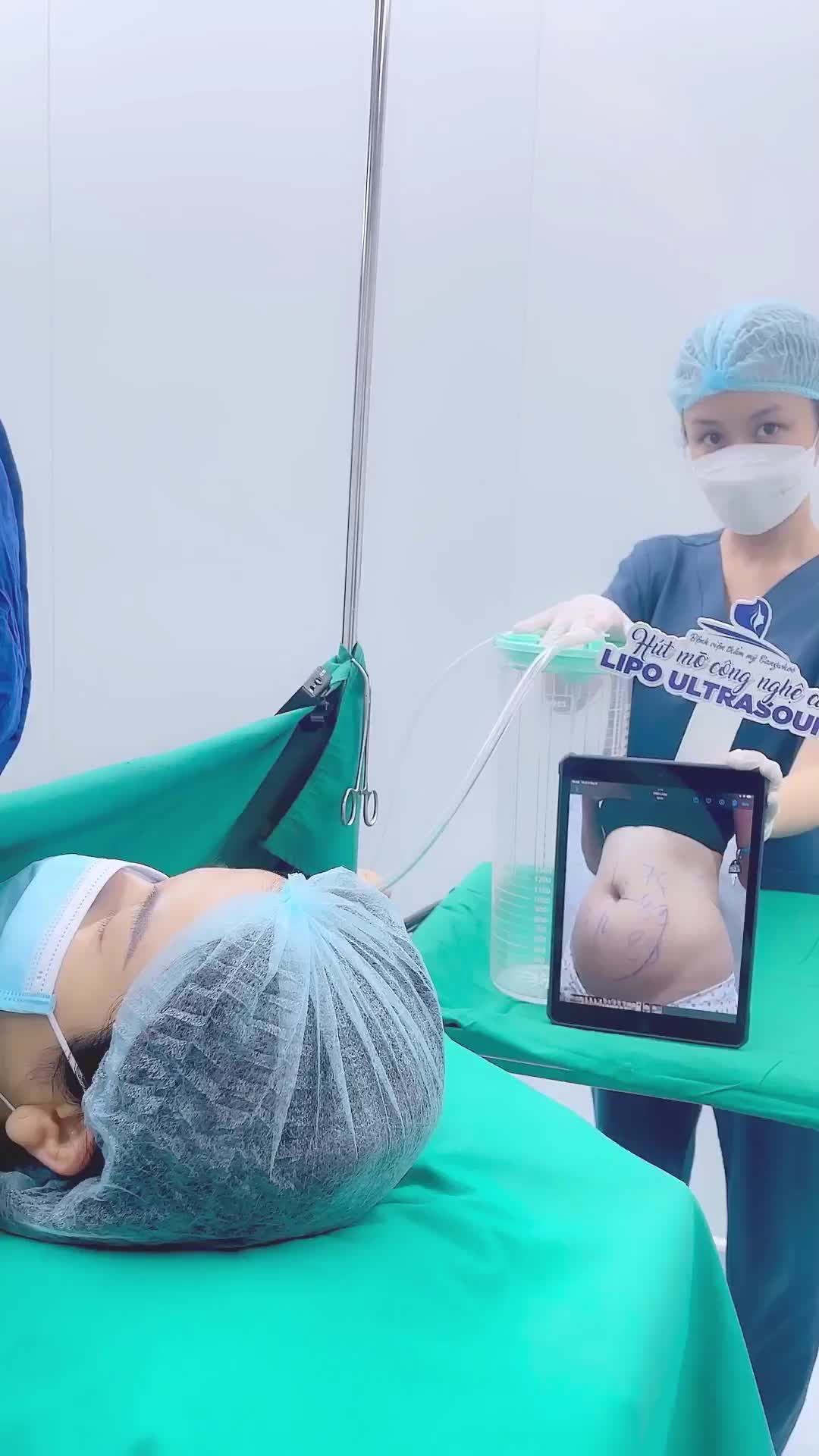 GIẢI CỨU BỤNG MỠ CHO CHỊ KHÁCH HÀNG ĐÃ SINH 4 CHÁU NHỜ HÚT MỠ CÔNG NGHỆ CAO LIPO ULTRASOUND