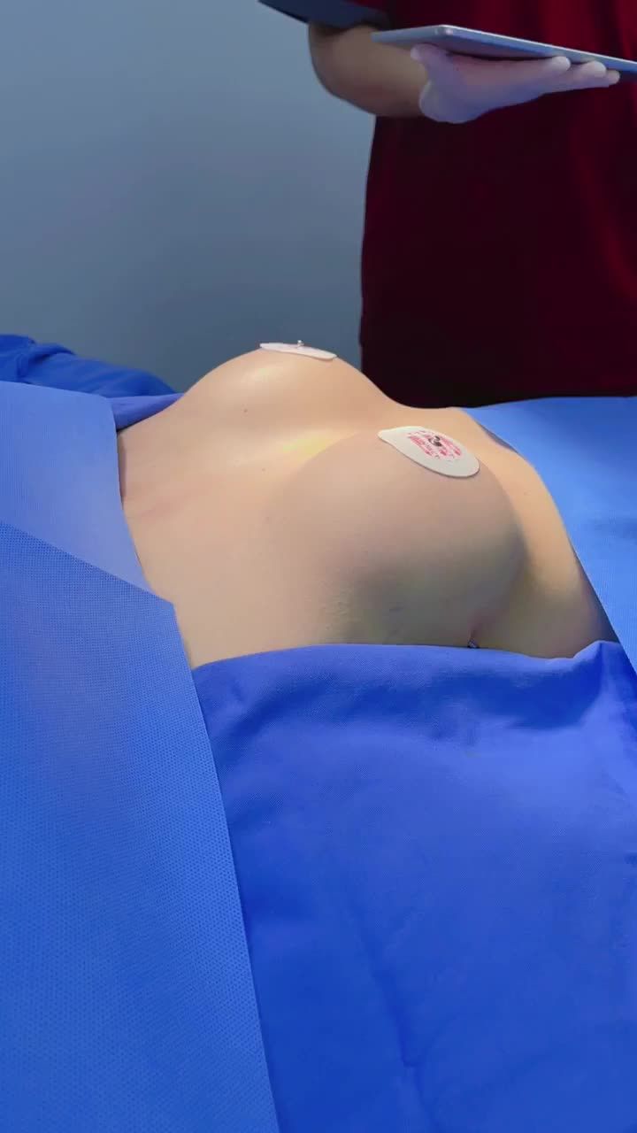 Kết quả phẫu thuật Nâng ngực tại Kangnam