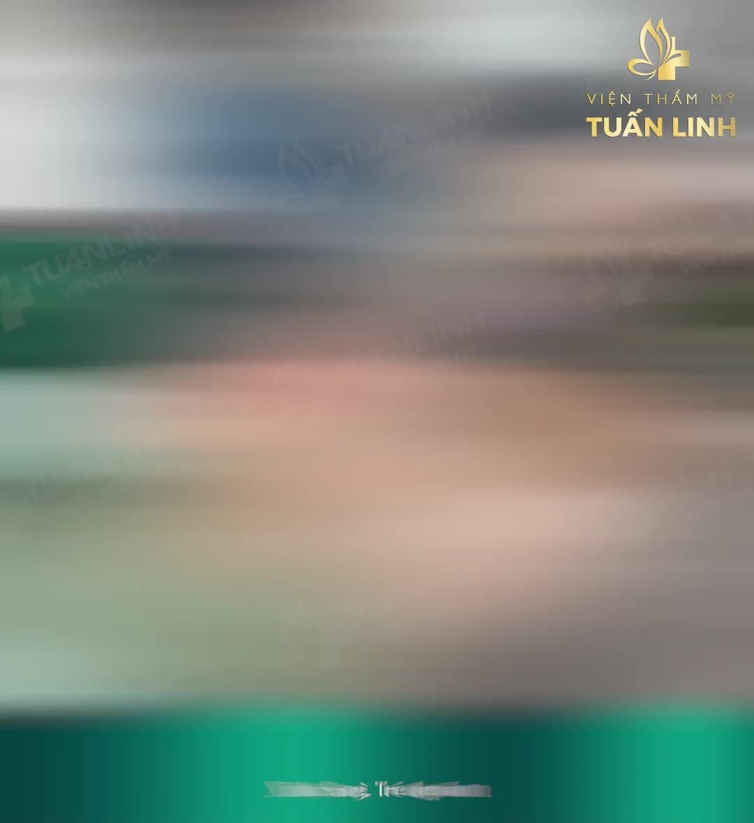 CÓ CÔNG NÂNG MŨI CÓ NGÀY XINH TƯƠI