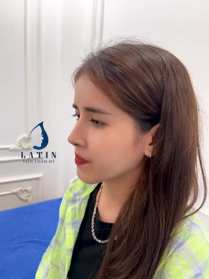 Dì em nói làm mũi mà tự nhiên thế nên hôm nay em dẫn Dì đến làm combo 10 dịch vụ tại Latin luôn ạ.