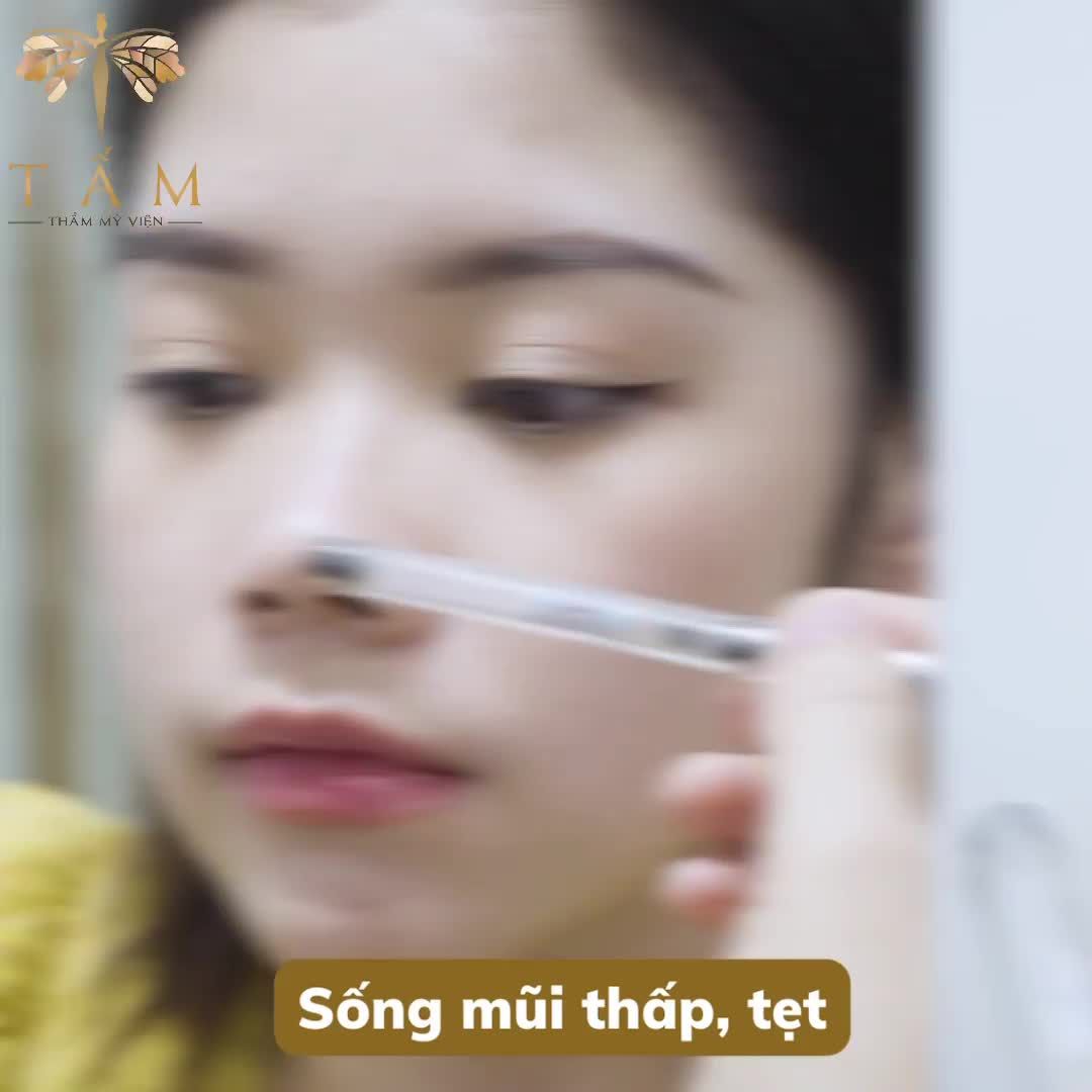 Hành trình thay đổi bản thân của khách hàng Linh Chi quá đỗi xuất sắc