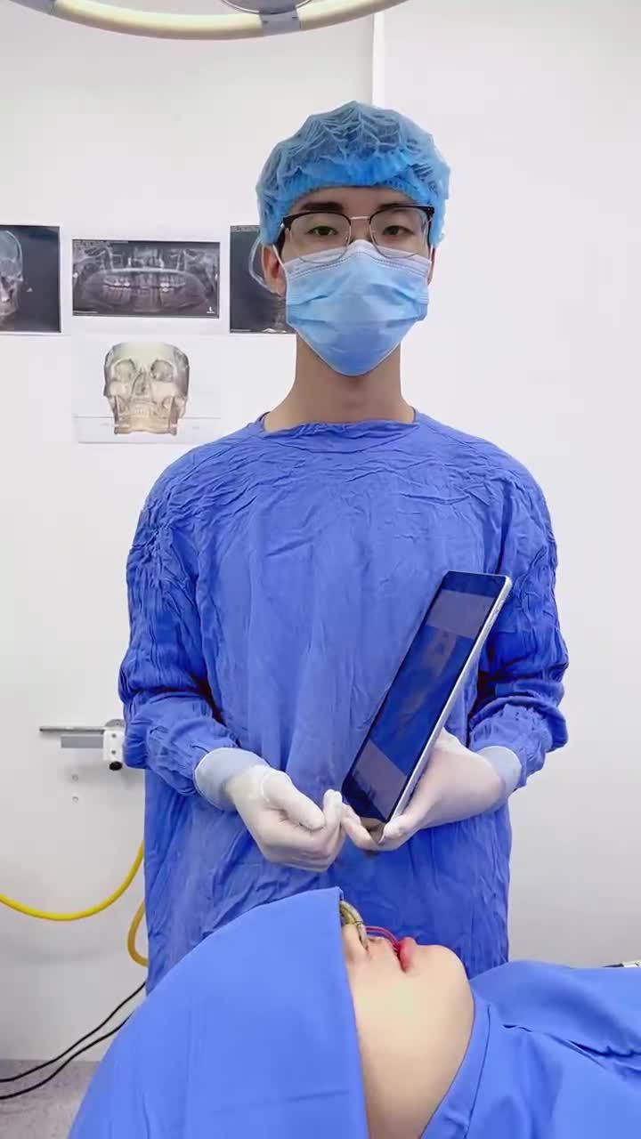 Kết quả gọt Hàm - Trượt cằm tại Kangnam