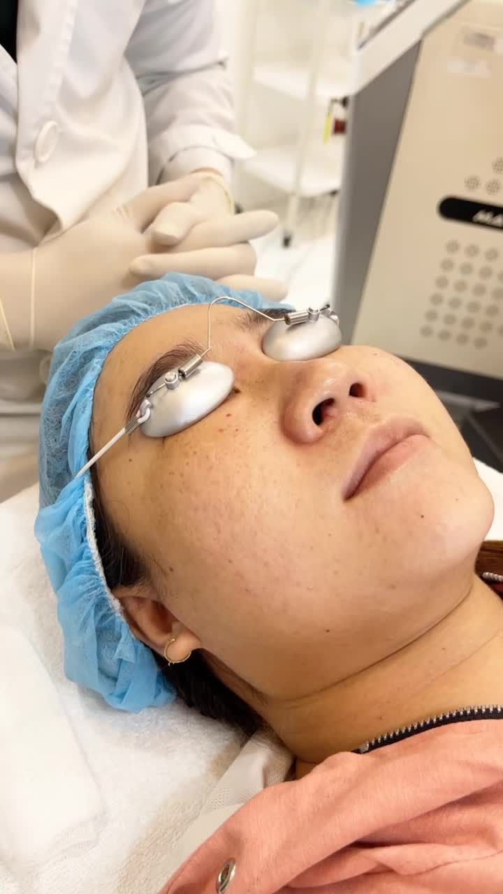 Đánh bay Tàn nhang chỉ sau 1 lần điều trị với công nghệ Laser Picosure tại Kangnam