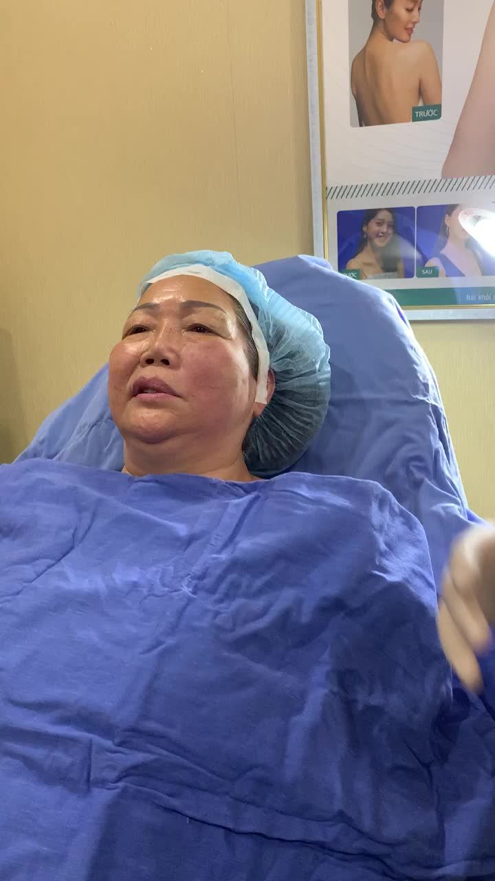 U70 Căng chỉ có hiệu quả không
