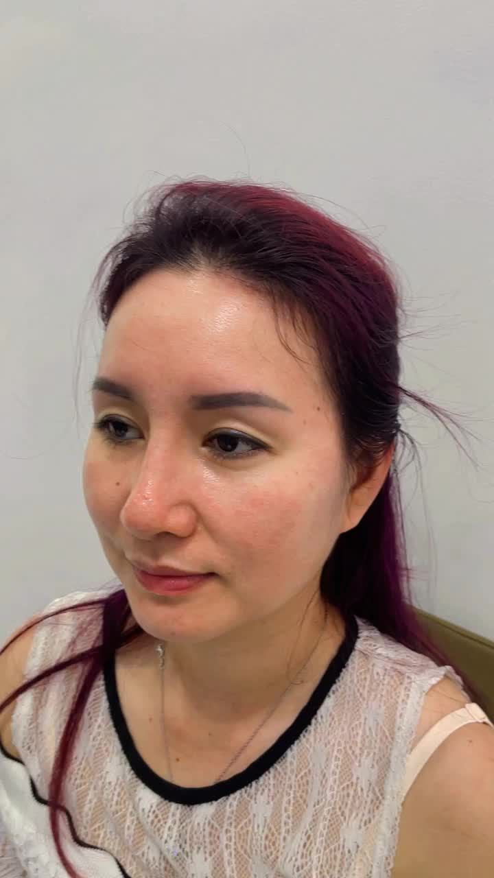 Chị khách từ Mỹ trở về - Chọn Kangnam nâng mũi 6D không đau