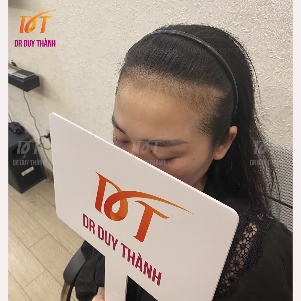 Lên video ca cấy tóc nữ hôm trước.