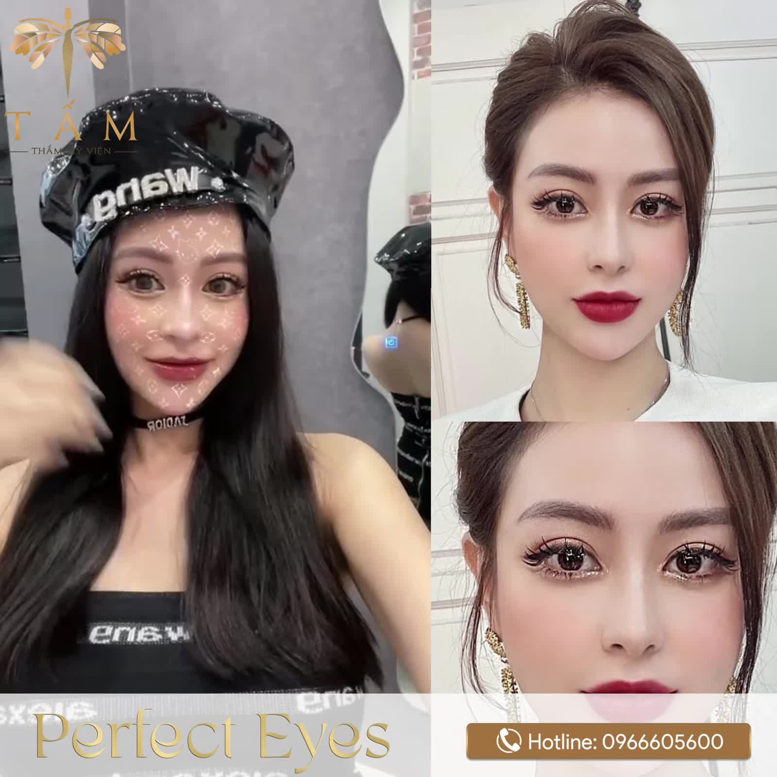 PERFECT EYES - KIẾN TẠO ĐÔI MẮT NÀNG THƠ