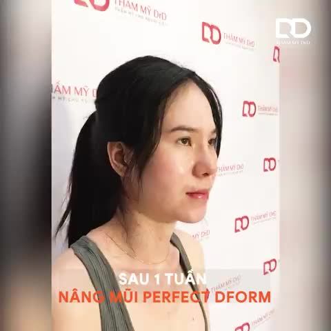 Ngạc nhiên chưa Không có sống mũi, da mũi mỏng vẫn lên dáng đẹp được nhé!