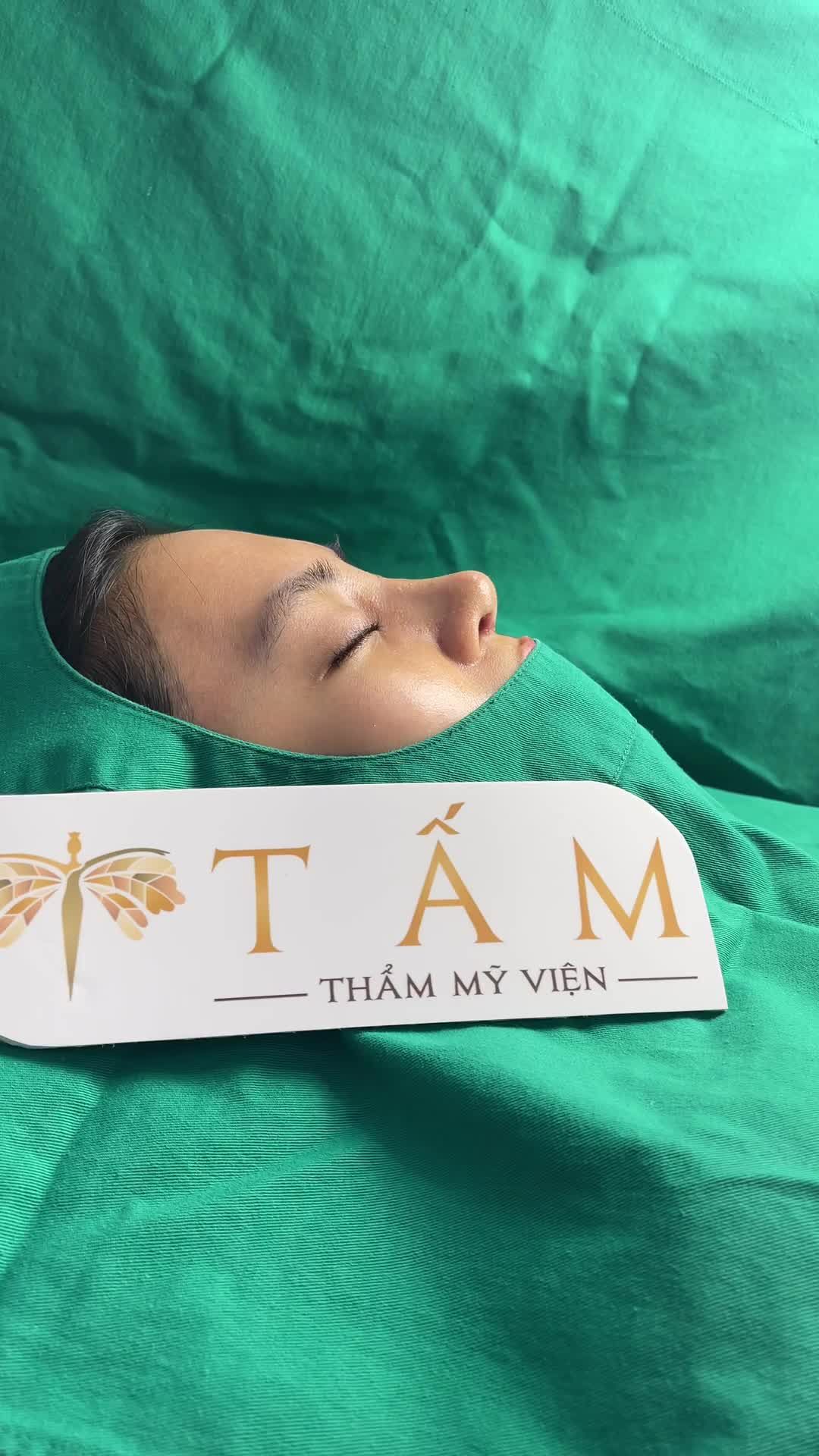Ngắm dáng mũi khách hàng sau tháo nẹp