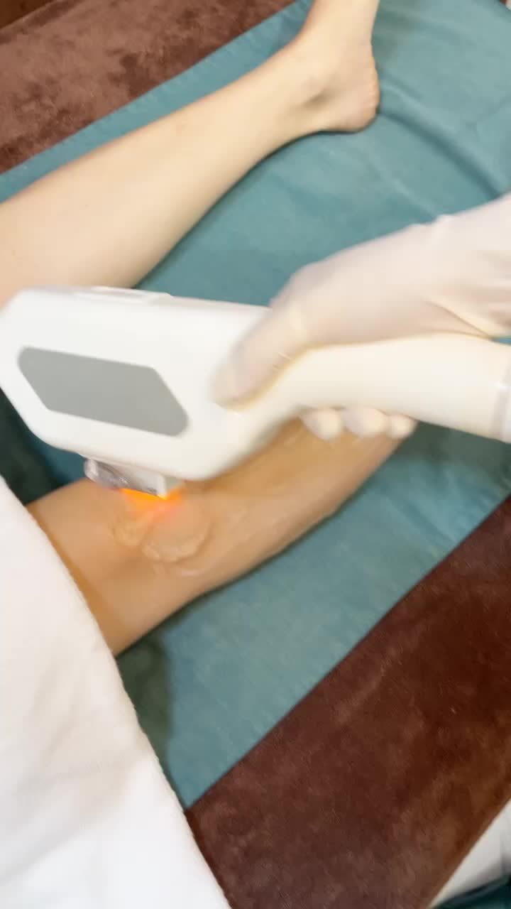 Triệt lông siêu sale - Giá còn chút xíu