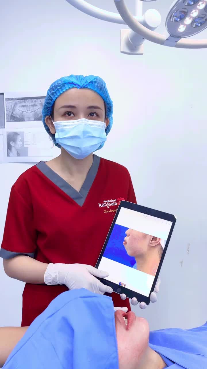 Hô biến hàm hô, hở lợi, càm lẹm thành tỉ lệ vàng chuẩn đẹp chỉ sau 2h phẫu thuật