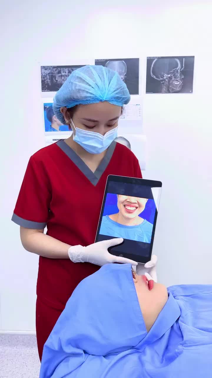 Quá thành công! Ca chỉnh hình hàm hô kết hợp trượt cằm quá là thành công