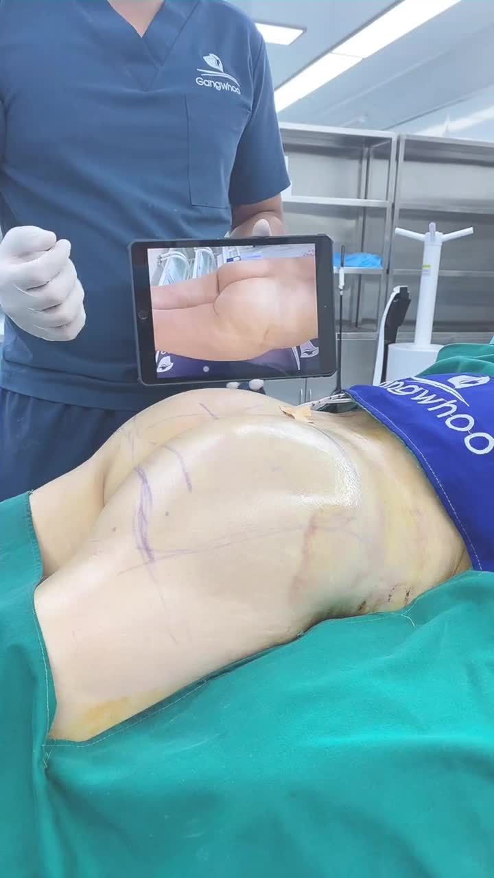 NÂNG MÔNG NỘI SOI - HOÀN THIỆN ĐƯỜNG CONG QUYẾN RŨ