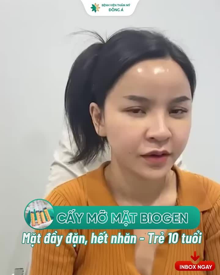 Chị Hiền Minh (39T - Sài Gòn) ghé BVTM Đông Á theo lịch hẹn tái khám sau CẤY MỠ TOÀN MẶT BIOGEN công nghệ Nhật Bản