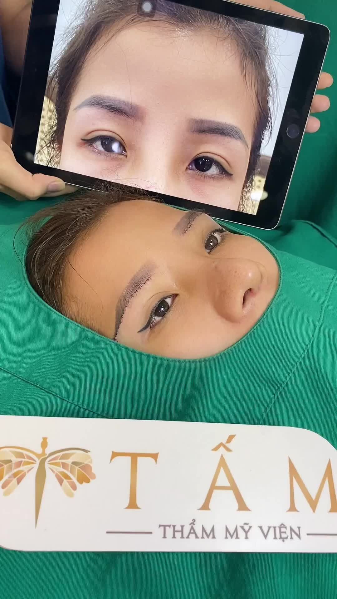 Thành quả sau khi nâng cung chân mày tại TMV Tấm. Cả nhà cùng theo dõi sự thay đổi trước và ngay sau làm nhé!