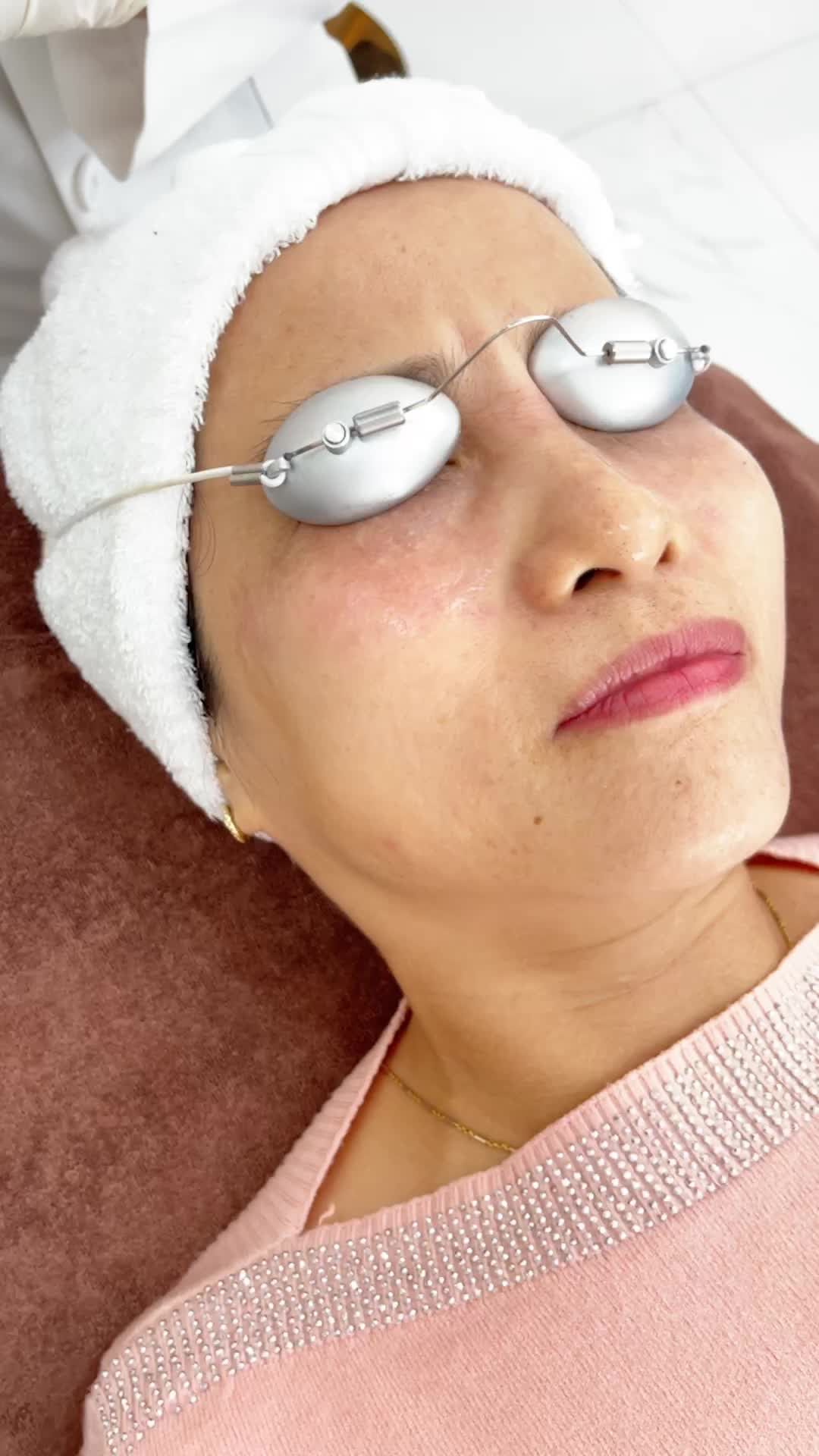 Cải thiện mụn thịt hiệu quả cùng công nghệ Laser tại Kangnam