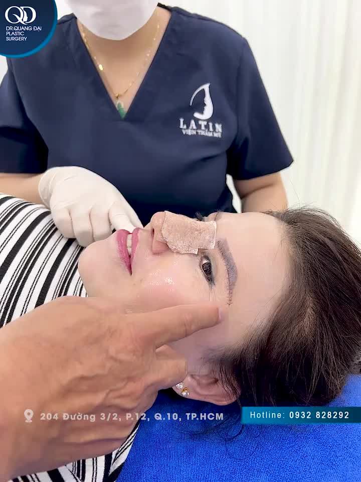Bác sĩ Đại tái khám 10 ngày cho chị khách hàng ở nước ngoài về