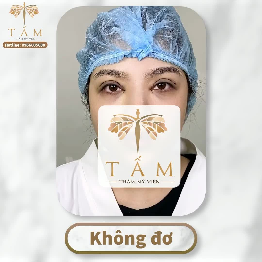 Tân trang đôi mắt -  Nhan sắc thăng hoa