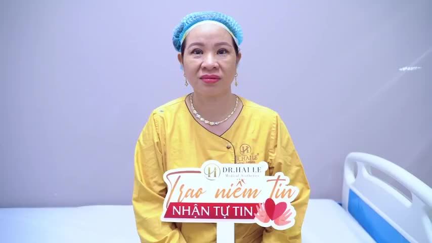 Những gì Dr.Hải Lê có thể mang đến cho bạn sau khi sửa mí đó chính là sự tự tin