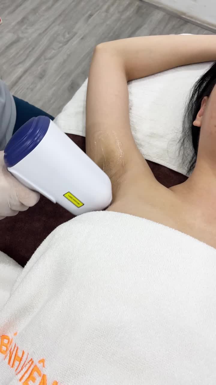 Quá trình triệt lông
