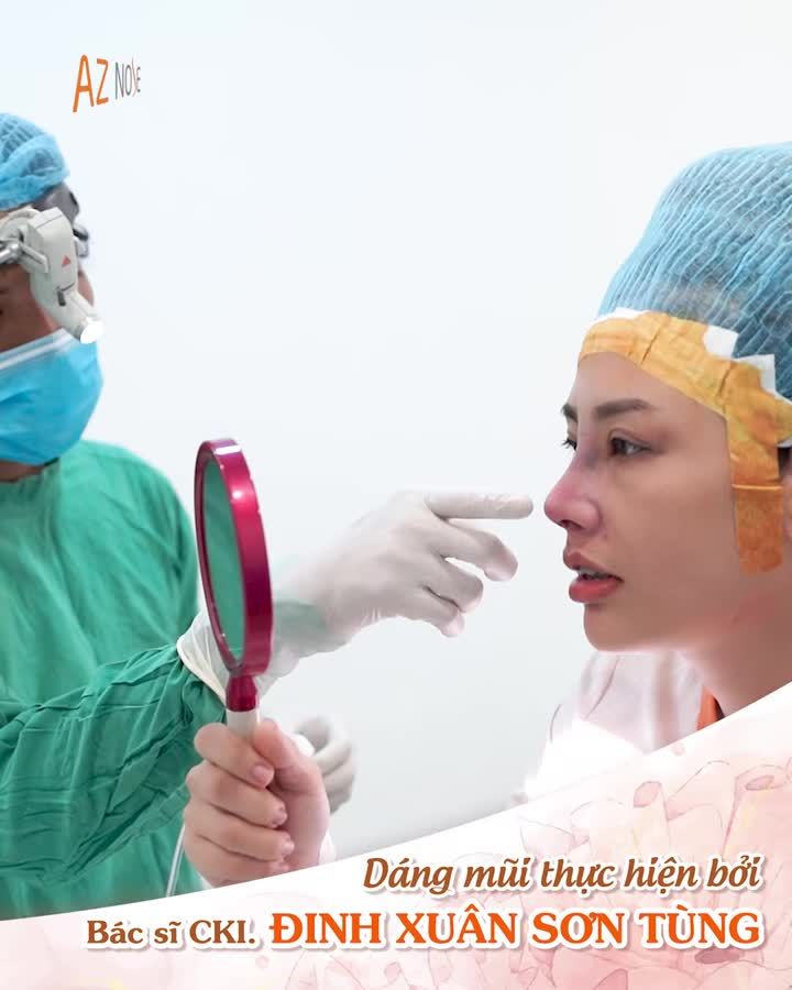Sở hữu dáng mũi thanh tú với phương pháp nâng mũi cấu trúc